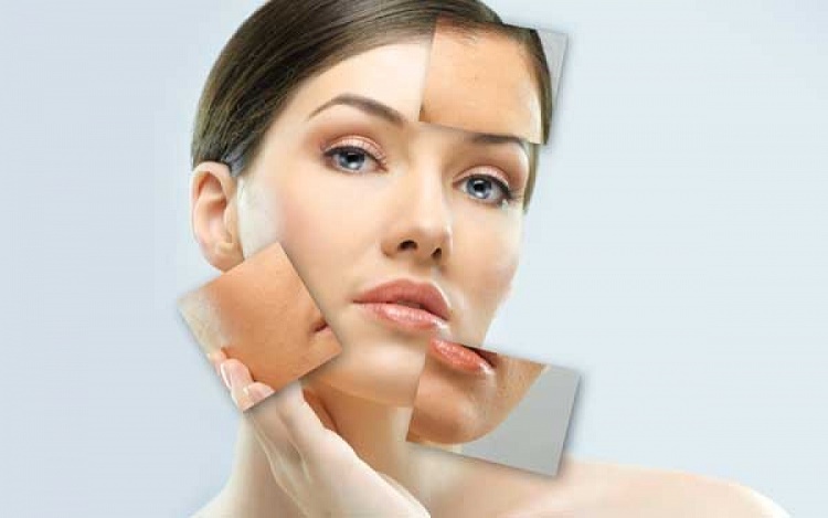professional skin treatment