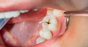5 Dentist-