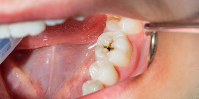 5 Dentist-