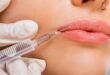 Cosmetic Injectable Dermal Fillers
