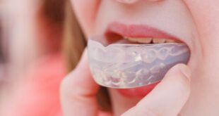 grinding mouthguard