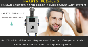 robotic hair transplant