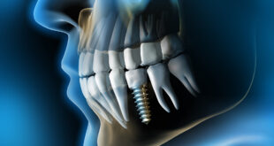 medical dental