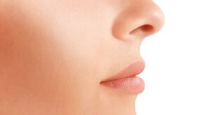 YOUR RHINOPLASTY RECOVERY TIME