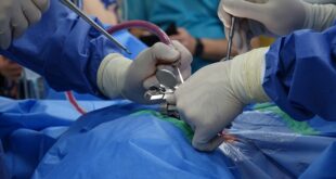 Advancements in Biodegradable Spinal Disc Materials: Are They the Future?