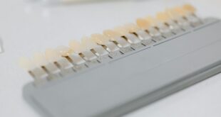 How Dental Veneers Can Transform Your Smile