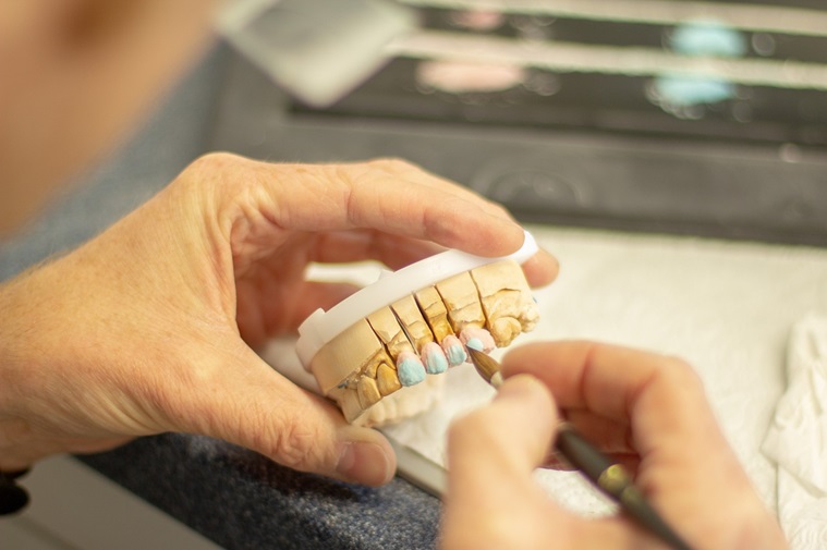 Implants, Bridges or Dentures: Which Option Endures and Delivers Value?