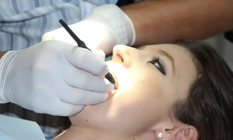 How Dental Veneers Can Transform Your Smile