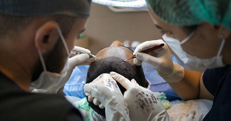 Hair Transplant: A Complete Guide to Modern Hair Restoration Solutions