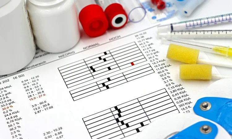 CARDIOLOGY Diagnosis and Tests: A Comprehensive Guide