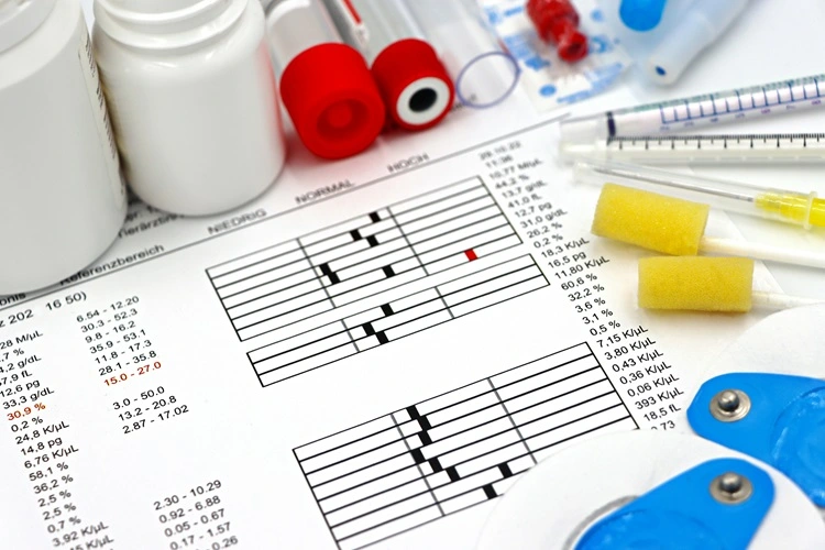 CARDIOLOGY Diagnosis and Tests: A Comprehensive Guide